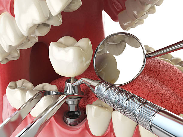 Best Emergency Dental Care for Sports Injuries in Algonac, MI
