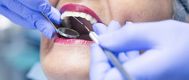 Best Emergency Dental Care for Sports Injuries in Algonac, MI